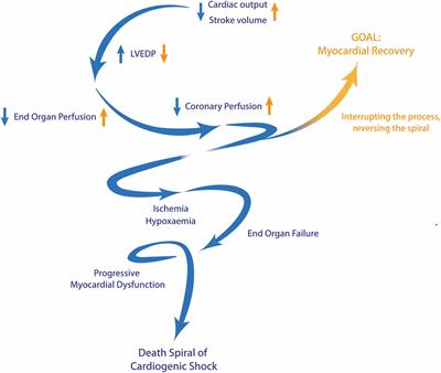 Acute coronary syndrome associated cardiogenic shock in the catheterization laboratory: peripheral veno-arterial extracorporeal membrane oxygenator management and recommendations